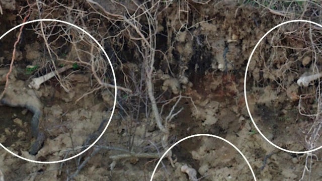 Bones are seen along the shoreline of Hart Island in New York City in this photo provided to CBS station WCBS-TV. 