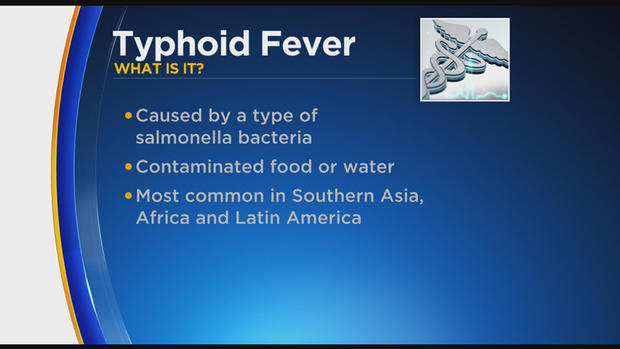 typhoid fever chart 