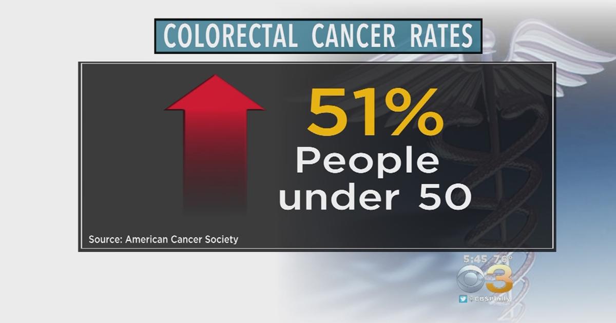 American Cancer Society Start Colon Cancer Screening At 45 Not 50
