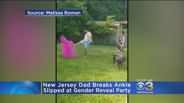 New Jersey Dad Breaks Ankle During Gender Reveal Party 