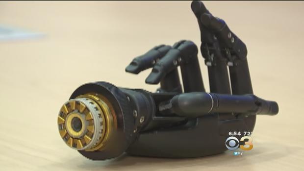 Man Buys Prosthetic Hand At Pawn Shop; Sets Out To Return It To Owner 