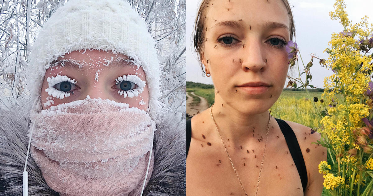 Remember the woman with frozen lashes that went viral? She's in