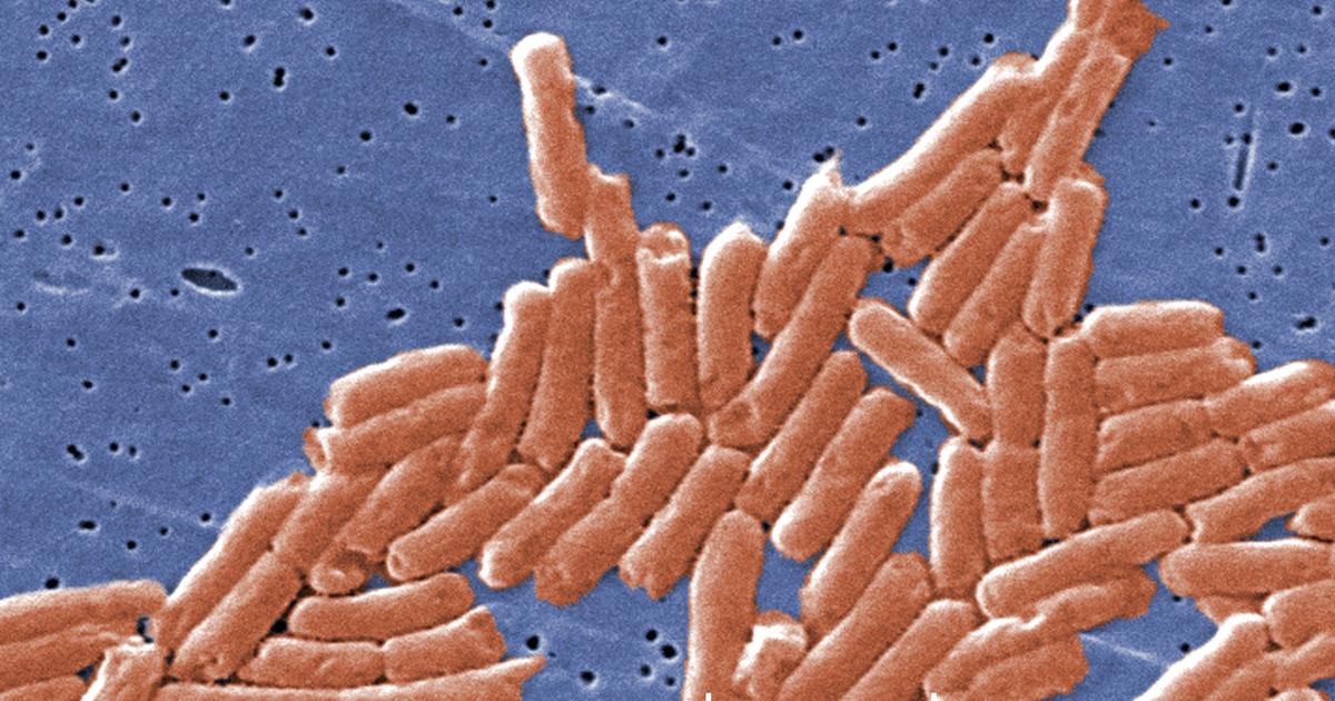 CDC probes charcuterie sampler sold at Sam's Club in salmonella outbreak