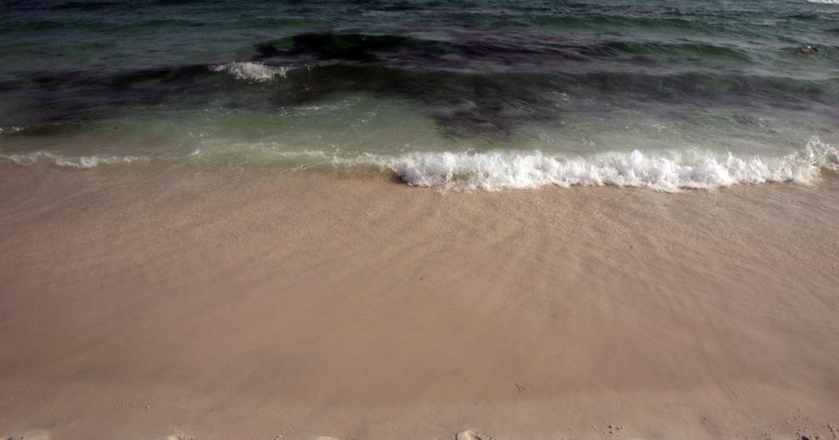 Teen infected with hookworms on Florida beach