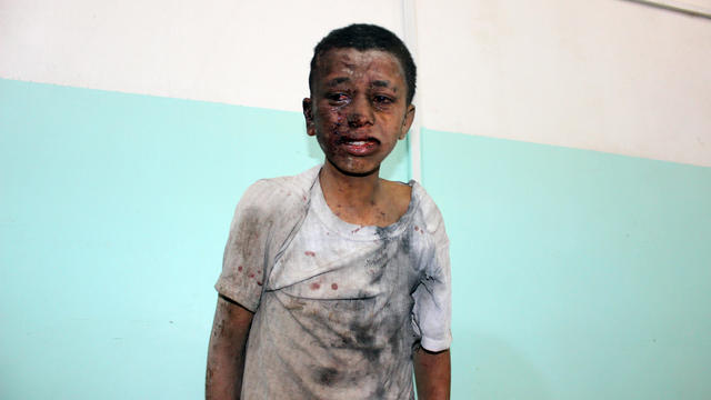 yemen airstrike hits bus of kids 