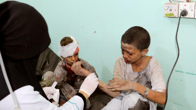 A doctor treats children injured by an airstrike in Saada 