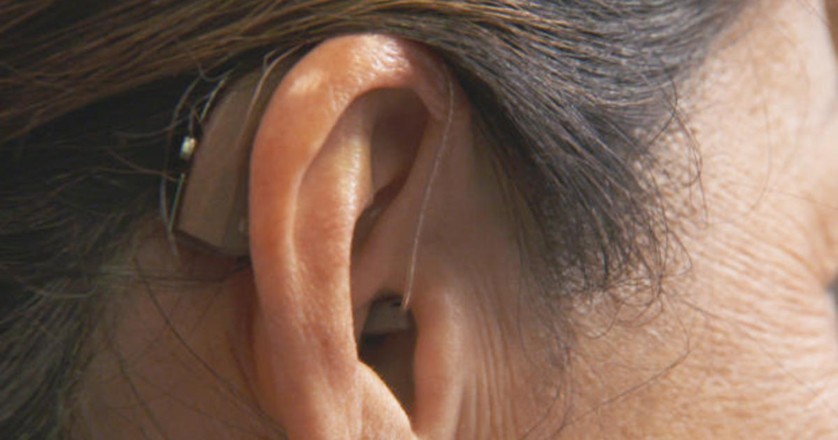 Biotech company aims to treat sudden hearing loss with early-stage drug