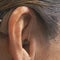 Biotech company aims to treat sudden hearing loss