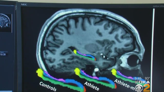 athlete-brain-scan.jpg 