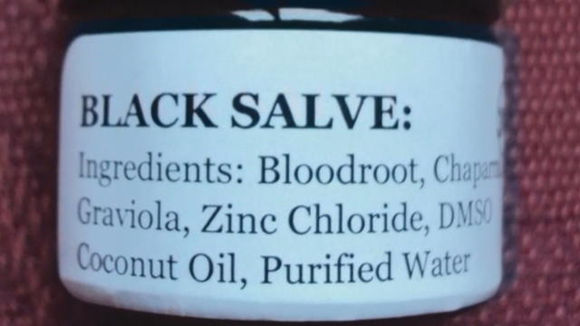 black-salve.jpg 