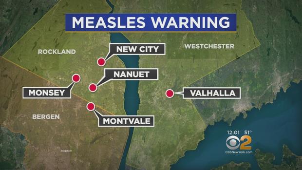 Map Of Measles Warnings 