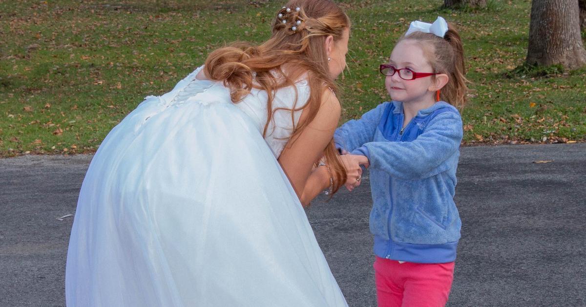 Bald Cinderella Helps Leukaemia Girl, 5, Feel Beautiful