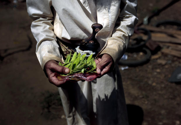 APTOPIX Yemen Displaced into Hunger Photo Essay 