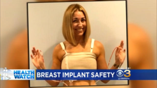 breast-implant-safety.jpg 