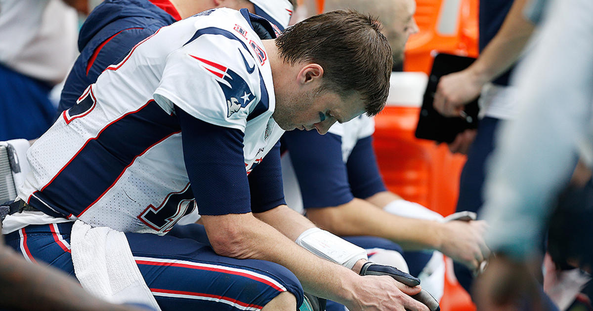 Tom Brady's History Of Playing Through Injury Is Kind Of Incredible - CBS  Boston