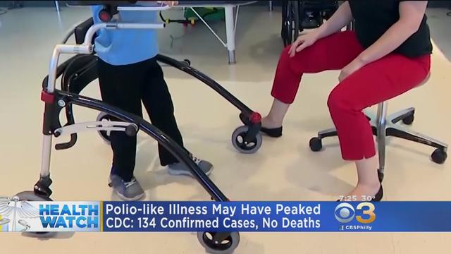 polio-illness.jpg 