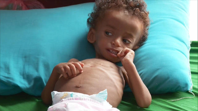 1217-ctm-yemendisplaced-palmer-1736551-640x360.jpg 