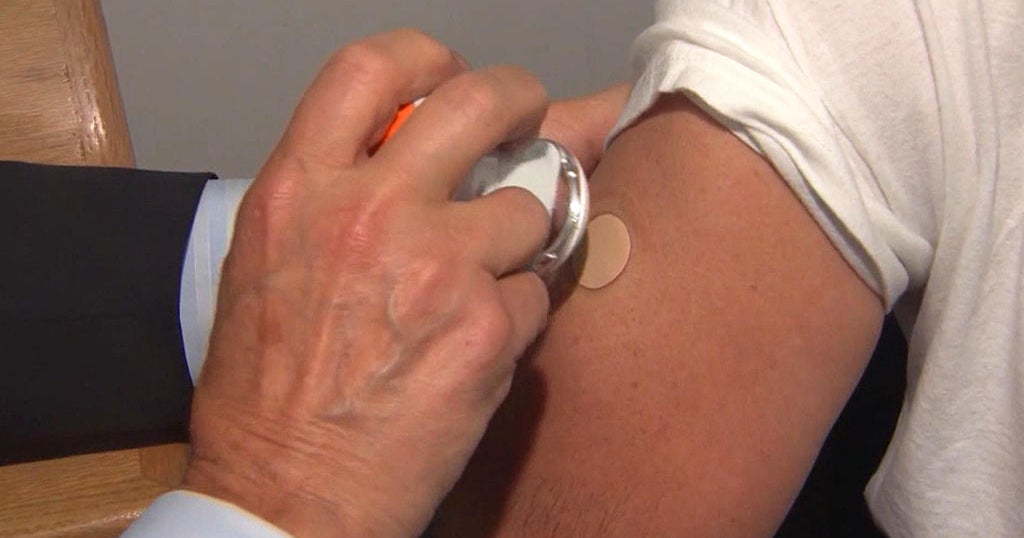 Migraine Patch Providing Quicker Pain Relief For Patients CBS Boston