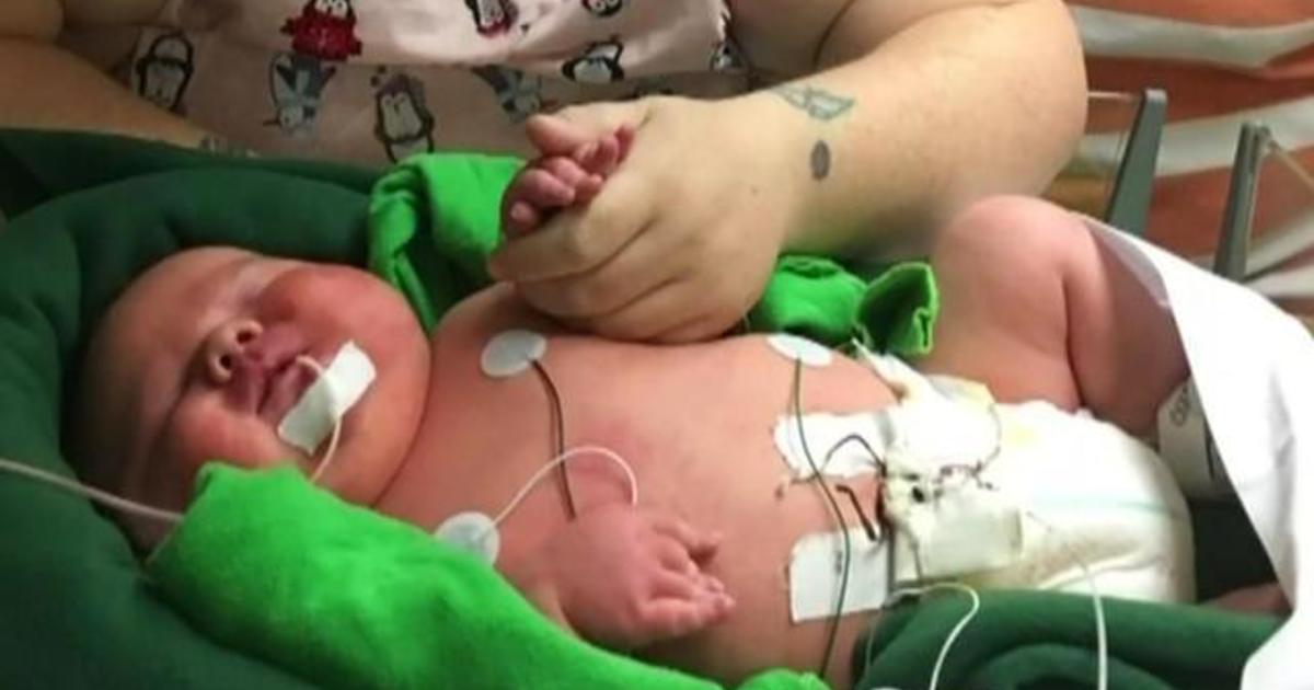 Parents Welcome Son Born Weighing Nearly 15 Pounds, Setting New Record