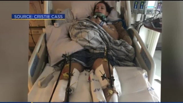 HIT-AND-RUN-LEGS.jpg 