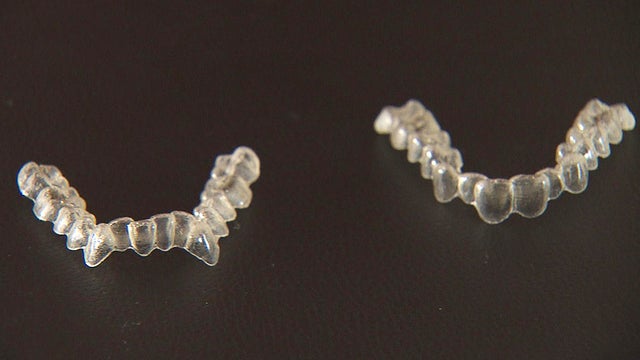 aligners.jpg 