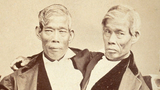 V0029573 Chang and Eng, conjoined twins, seated. P 