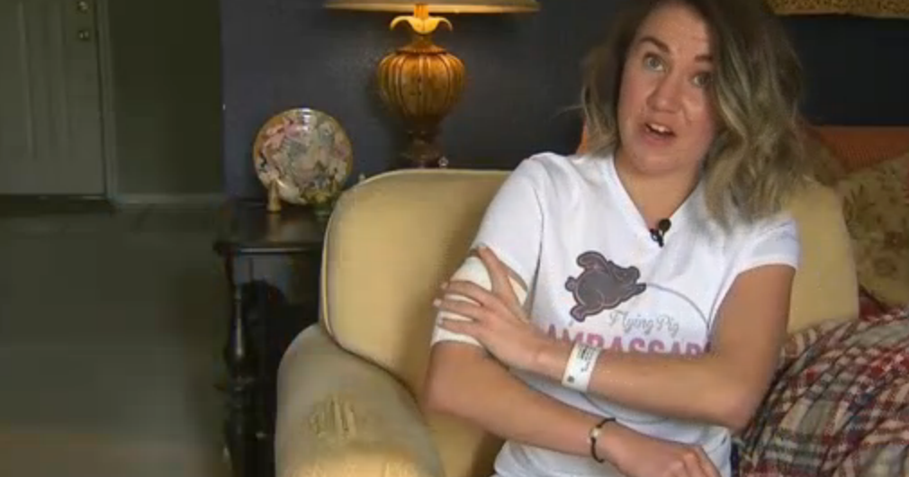 Elite Runner Out Of Hospital After Vicious Dog Attack In Fort Worth ...