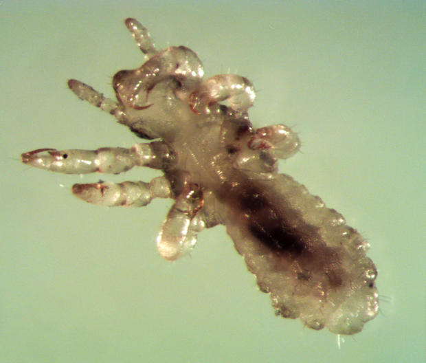 Head louse (pediculus humanus capitis) at 60X, ventral view. 