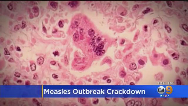 measles-outbreak.jpg 