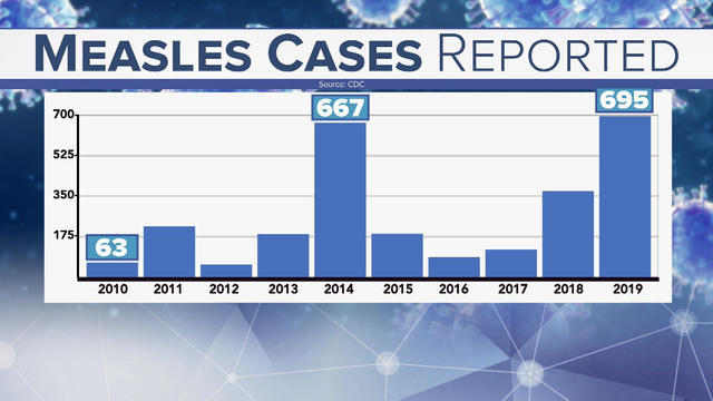 0429-cbsnam-healthwatchmeasles-1839765-640x360.jpg 