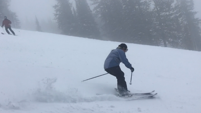 3-D ANKLE BONE 6PKG.transfer_frame_1876 