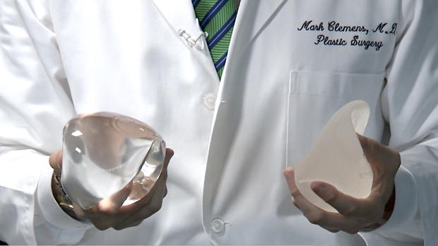 breast implants - cancer 