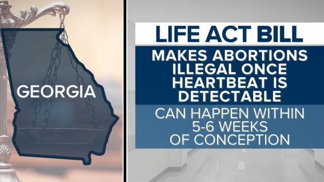 cbsn-fusion-heartbeat-bill-legislation-in-georgia-would-ban-abortions-after-heartbeat-detected-thumbnail-1844881.jpg 