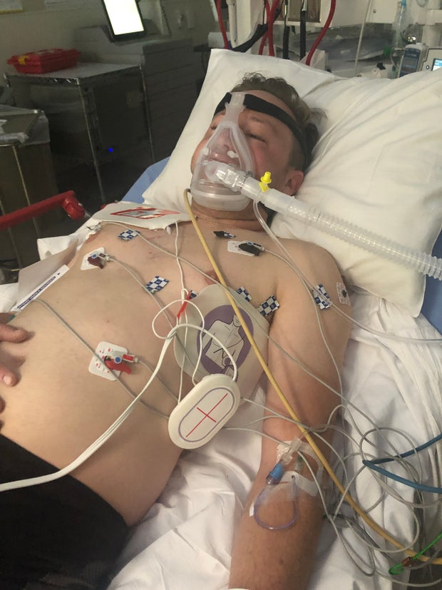 kyle woods runner cardiac arrest 