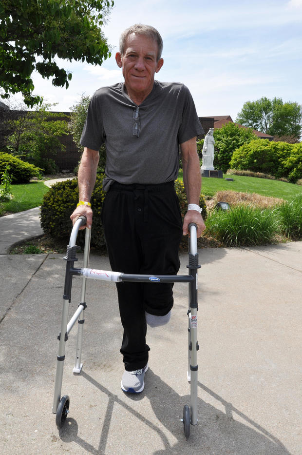 Kurt Kaser is seen in a photo released by Madonna Rehabilitation Hospitals. 