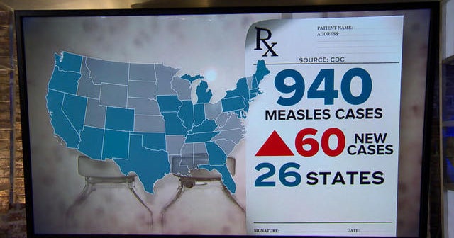 Us Measles Outbreak 2025