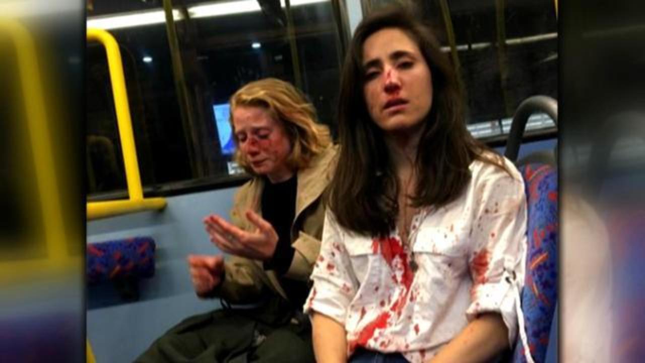 London bus attack Lesbian couple brutally beaten by teens on bus; four teens arrested today picture image