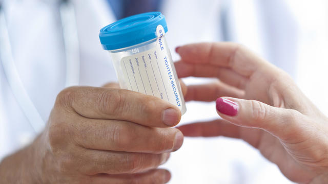 Doctor handing container with urine sample to a woman 