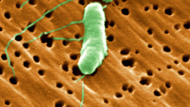 flesh-eating-bacteria.jpg 