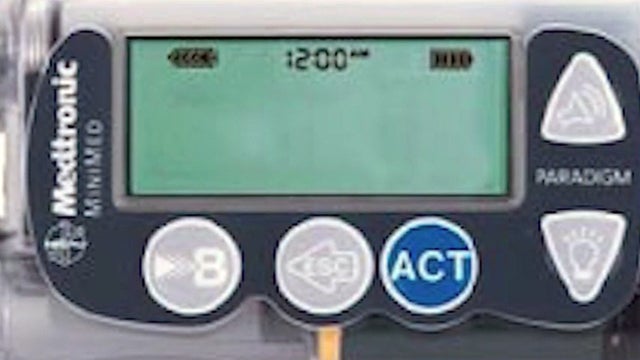 insulinpump.jpg 