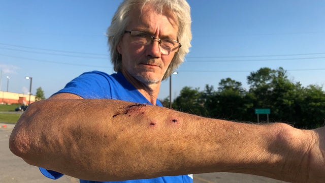 rabid-bobcat-attack.jpg 