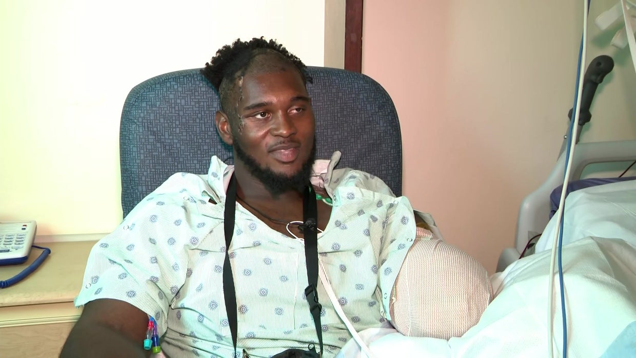 Exclusive Injured Miami Dolphins Player Kendrick Norton Speaks For