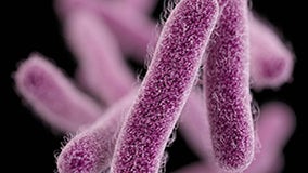 16878_lores-DR-shigella.jpg 