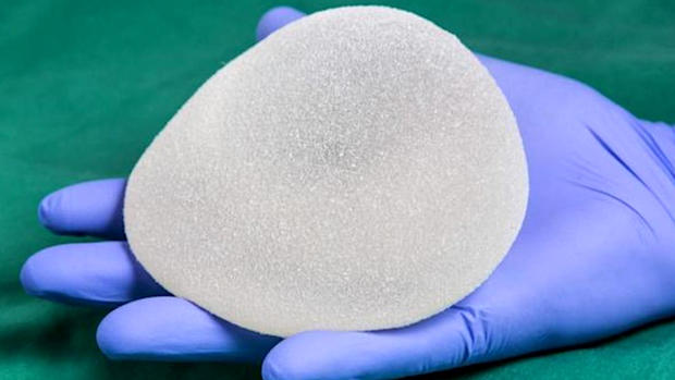 textured breast implant 