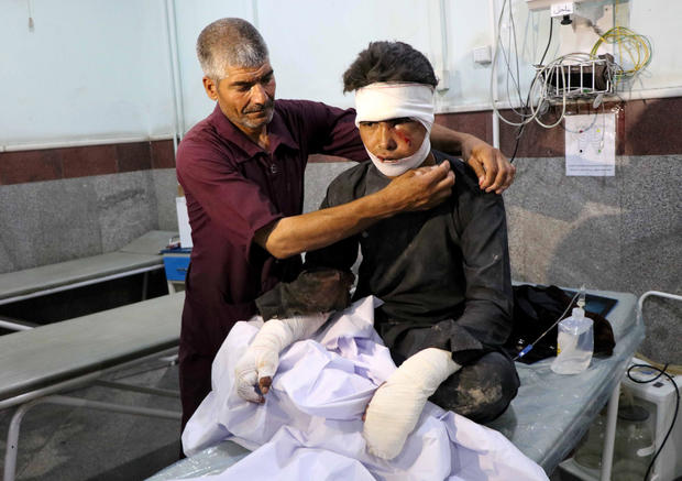 An Afghan man receives treatment at a hospital after a bus was hit by a roadside bomb in Herat province 