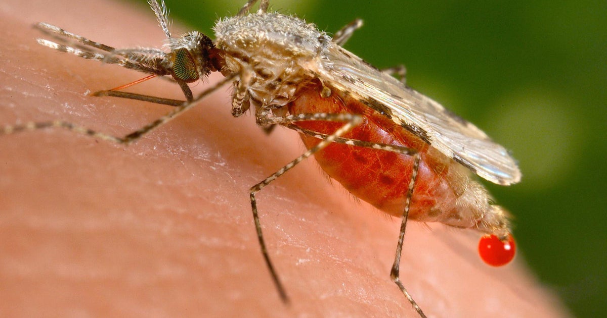 0803 ctm manvsmosquito michelle How Many People Have Mosquitoes Killed in Total? Shocking Stats!