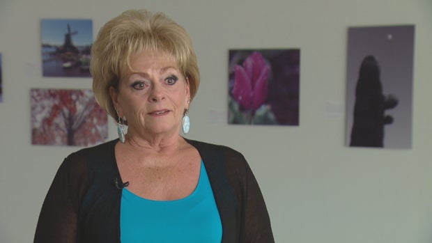 CORNEA TRANSPLANT PHOTOS 5PKG_frame_2378 