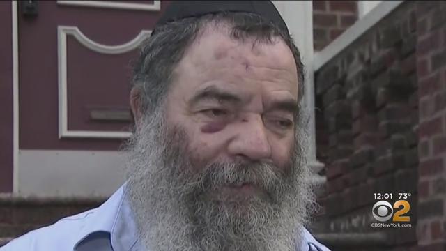 Victim-speaks-after-suspected-anti-semitic-attack.jpg 