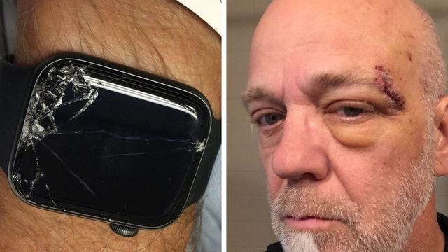 apple-watch.jpg 