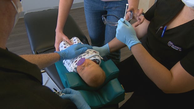 TONGUE TIE 6PKG.transfer_frame_1792 